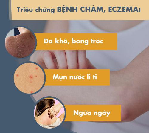 Phòng ngừa Bệnh Chàm và Vảy Nến